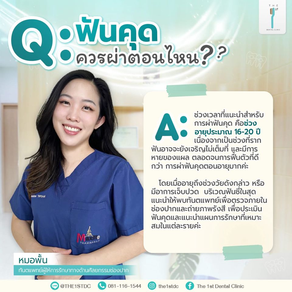 ฟันคุด ควรผ่าตอนไหน — ผ่าฟันคุด, อายุที่เหมาะผ่าฟันคุด, ฟันคุด