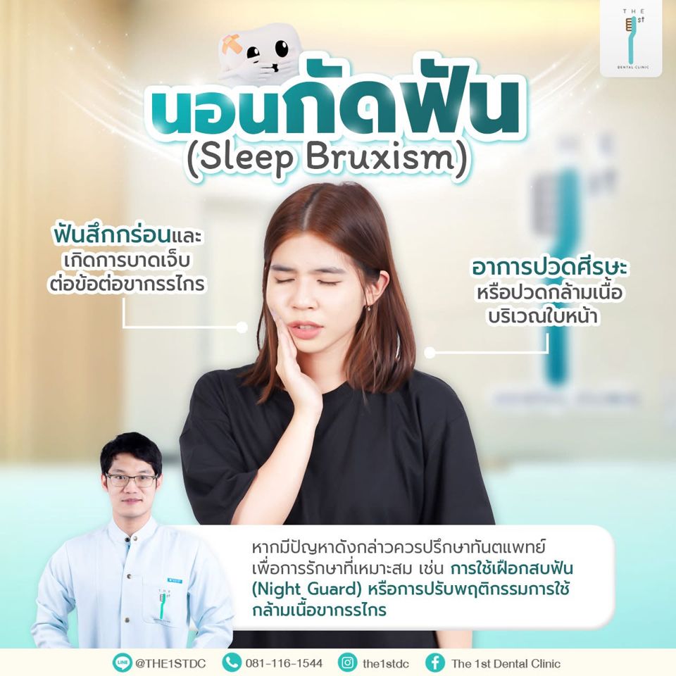 นอนกัดฟัน (Sleep Bruxism) — นอนกัดฟัน, Night Guard, ฟันสึก