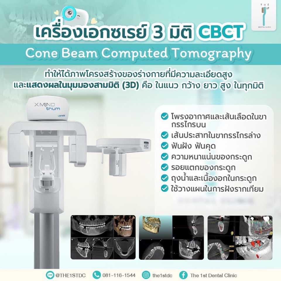 เครื่องเอกซเรย์ 3 มิติ CBCT — CBCT, เอกซเรย์ฟัน 3 มิติ, วางแผนรากฟันเทียม