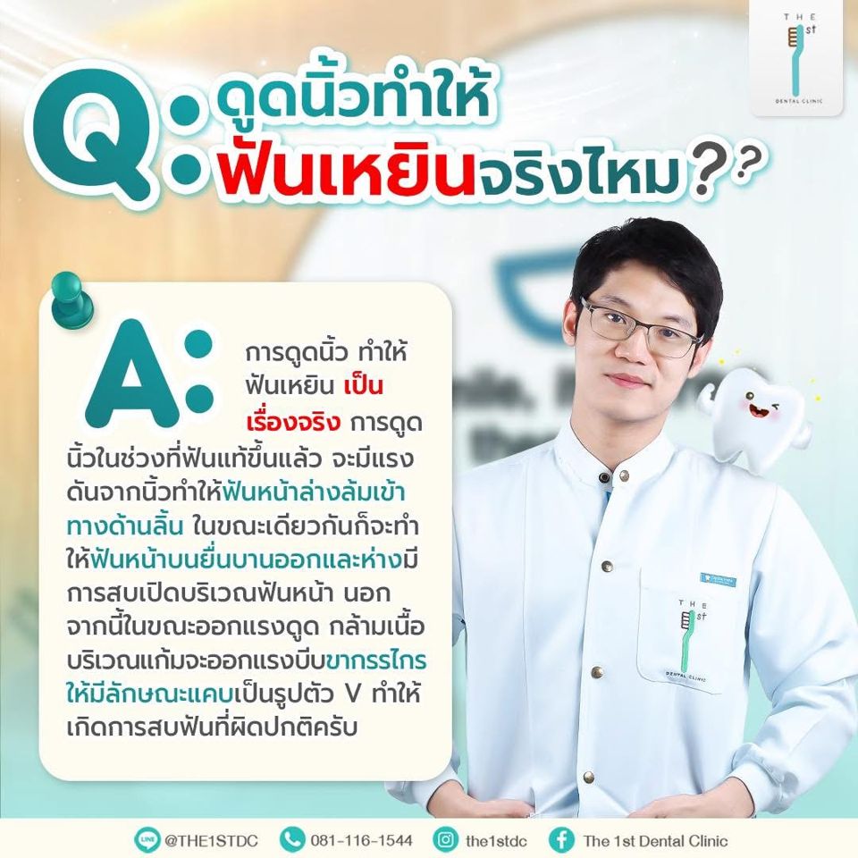 ดูดนิ้วทำให้ฟันเหยินจริงไหม — ดูดนิ้ว, ฟันเหยิน, สบฟันผิดปกติ