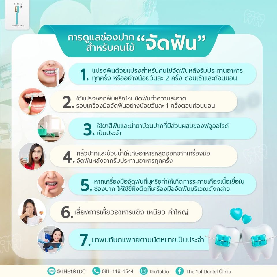 การดูแลช่องปากสำหรับคนไข้จัดฟัน — ดูแลฟันขณะจัดฟัน, แปรงซอกฟัน, คนไข้จัดฟัน