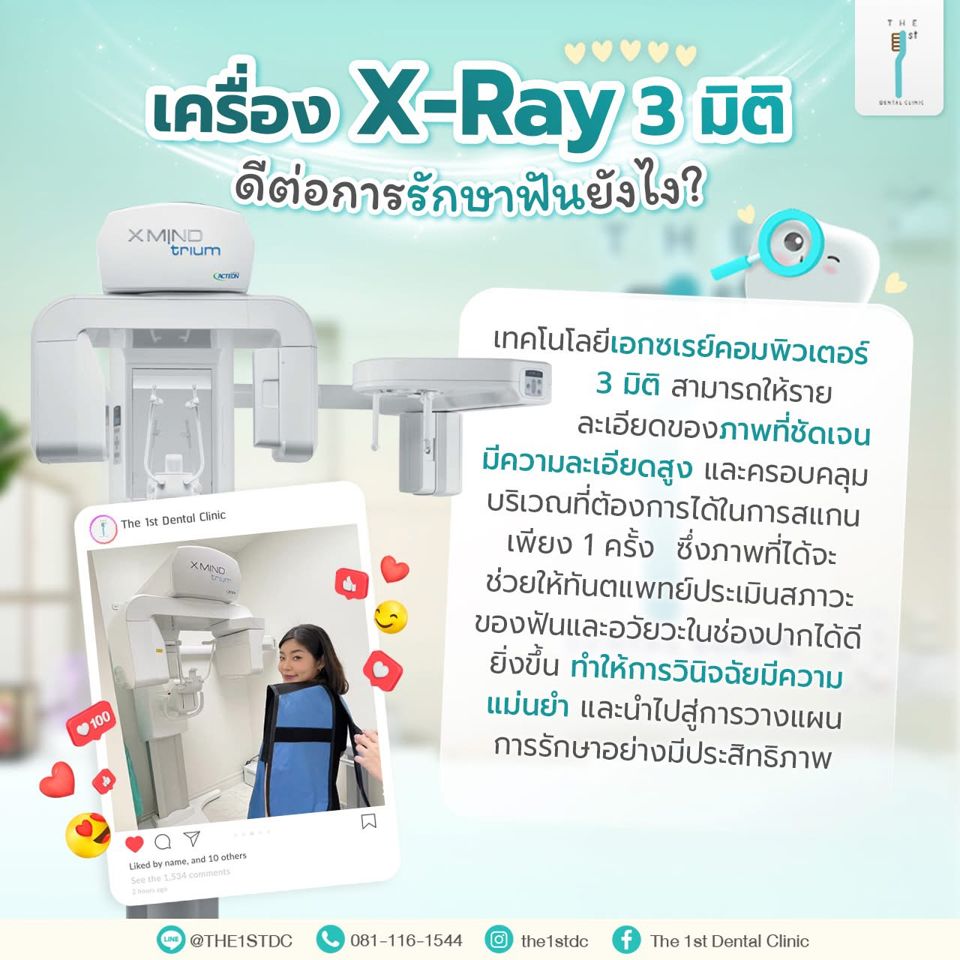 เครื่อง X-Ray 3 มิติ ดีต่อการรักษาฟันอย่างไร — X-Ray 3 มิติ, เอกซเรย์ฟัน, วินิจฉัยแม่นยำ