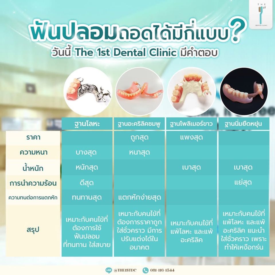 ฟันปลอมถอดได้มีกี่แบบ — ฟันปลอมถอดได้, ฟันปลอมฐานโลหะ, ฟันปลอมฐานอะคริลิก