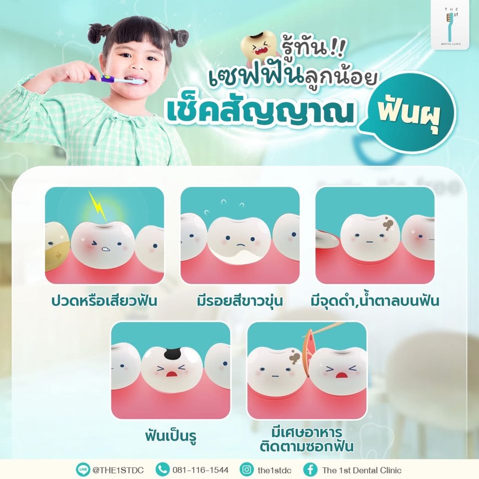 เช็คสัญญาณฟันผุในเด็ก — ฟันผุเด็ก, ฟันน้ำนมผุ, สัญญาณฟันผุ