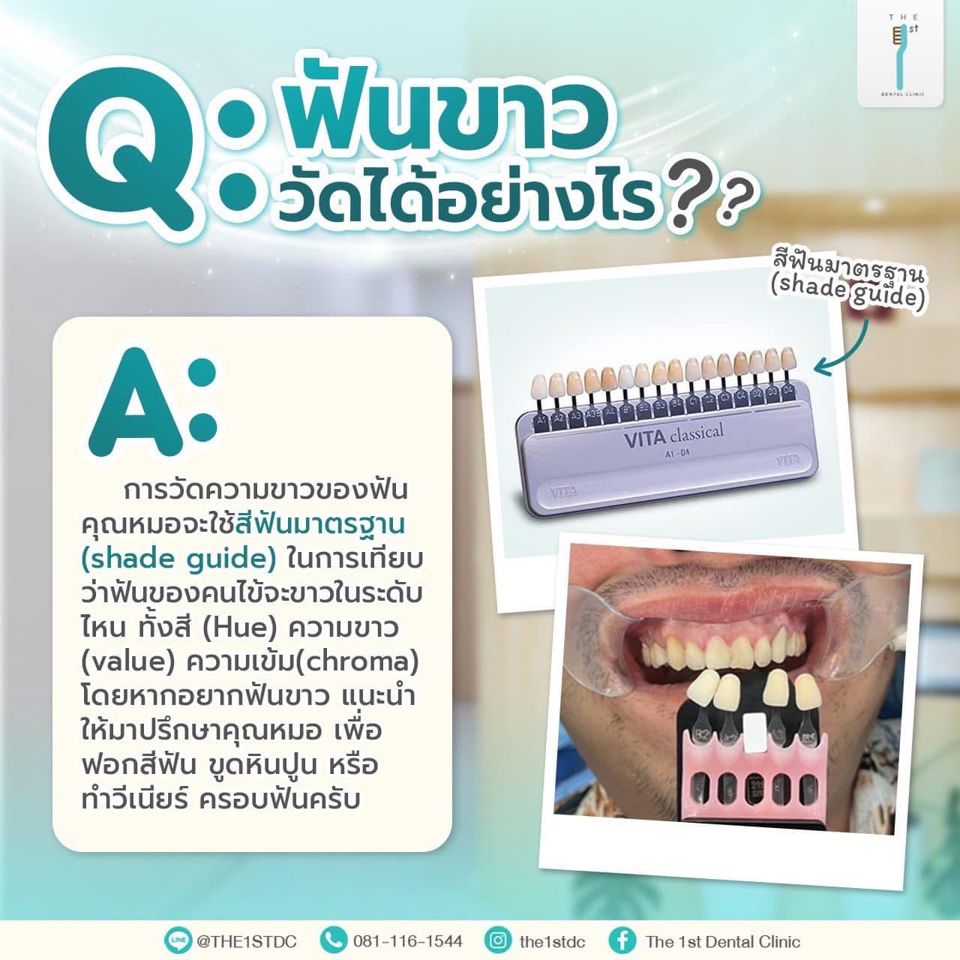 ฟันขาว วัดได้อย่างไร — Shade guide, ฟันขาว, ฟอกสีฟัน